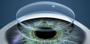 Cornea